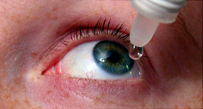 Синдром «сухого» глаза: причины и последствия.